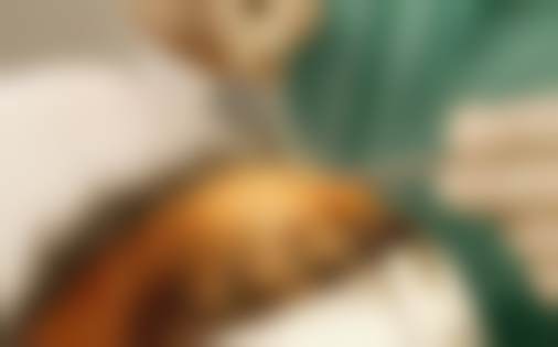 西安丝倍梵植发医疗美容诊所西安丝倍梵植发技术