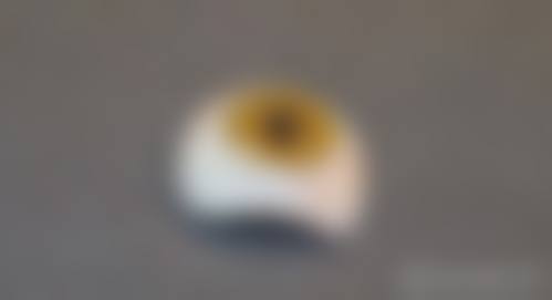深圳市儿童医院眼科擅长项目。