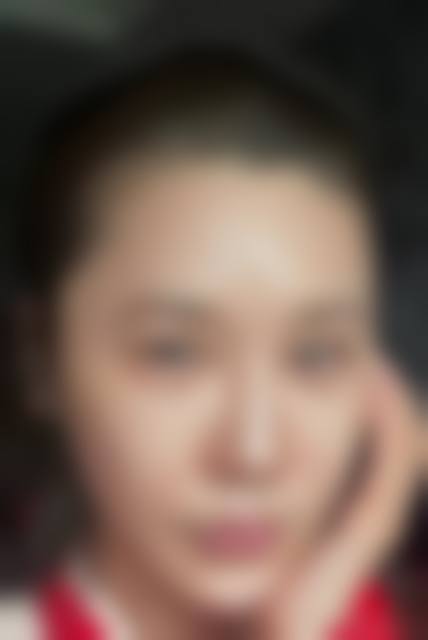 商丘德尔美客整形医院项目优势