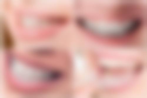 陈医洁医生技术优势