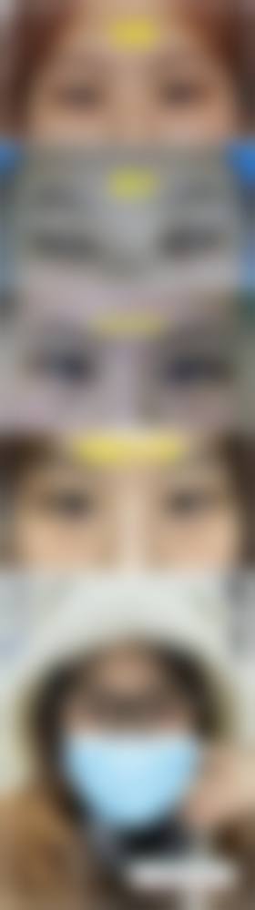 攀枝花春语医疗美容诊所治疗反馈与口碑评价。