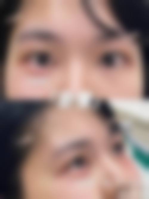 攀枝花春语医疗美容诊所擅长项目。
