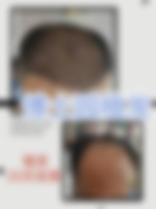 哈尔滨壹美整形医院擅长项目