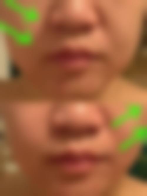 无锡蔷薇花盛医疗美容门诊部擅长项目。