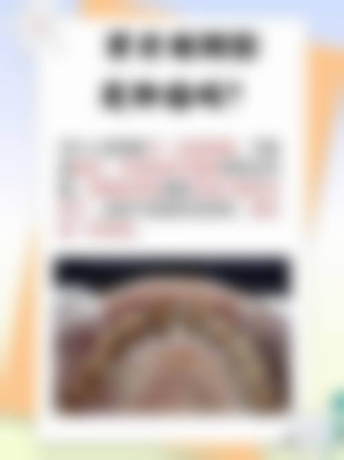 珠海固德口腔诊所治疗反馈与口碑评价。