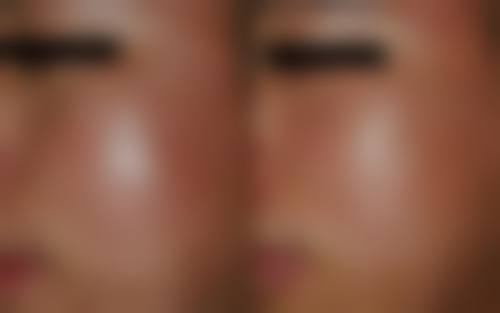 贵阳美吉拉(金馨)医疗美容门诊部治疗反馈与口碑评价。