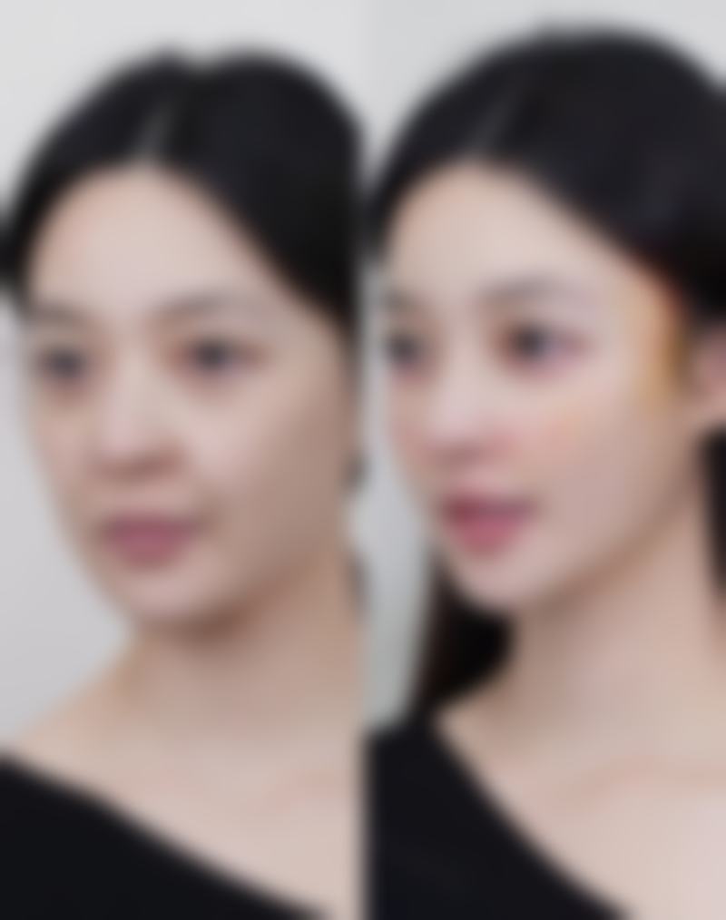 洛阳唯医医疗美容门诊部擅长项目。