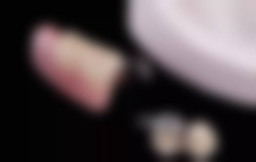 郭雄飞医生技术优势