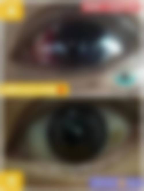 大连爱尔马桥眼科诊所治疗反馈与口碑评价。