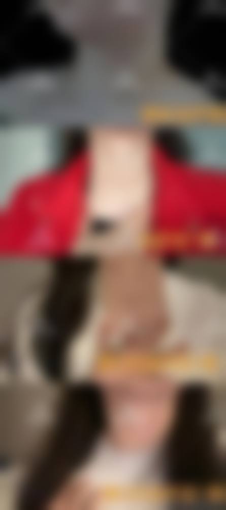 盐城比尔吉美整形医疗美容诊所擅长项目。