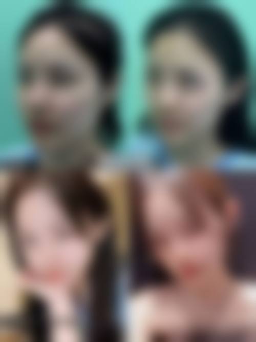 盐城比尔吉美整形医疗美容诊所医生团队经验稳定。