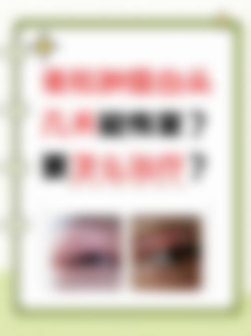 北京市丰台中医和西医结合医院眼科擅长项目。