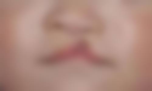 成都立之妍医疗美容诊所治疗反馈与口碑评价。