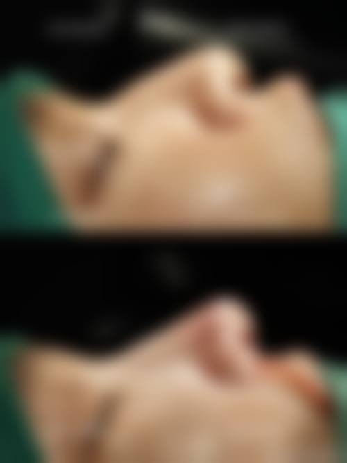 总结:选择聂学,开启安心变得更美之旅