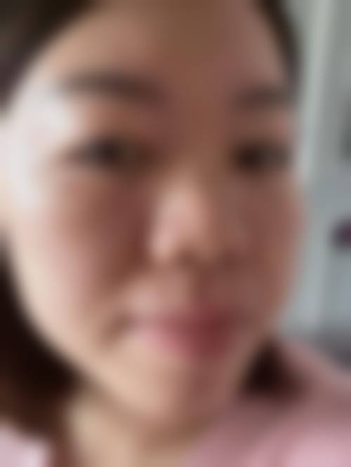 河津沐颜兮整形医院擅长项目。