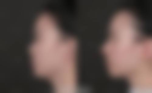 优惠活动详情：限时补贴，美丽不贵