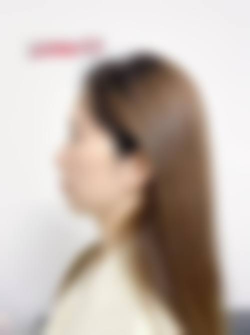 宝鸡优齿贝口腔诊所医生团队经验稳定。