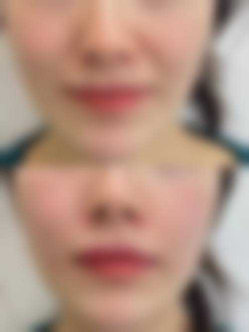 济南臻美星尘医疗美容诊所擅长项目。