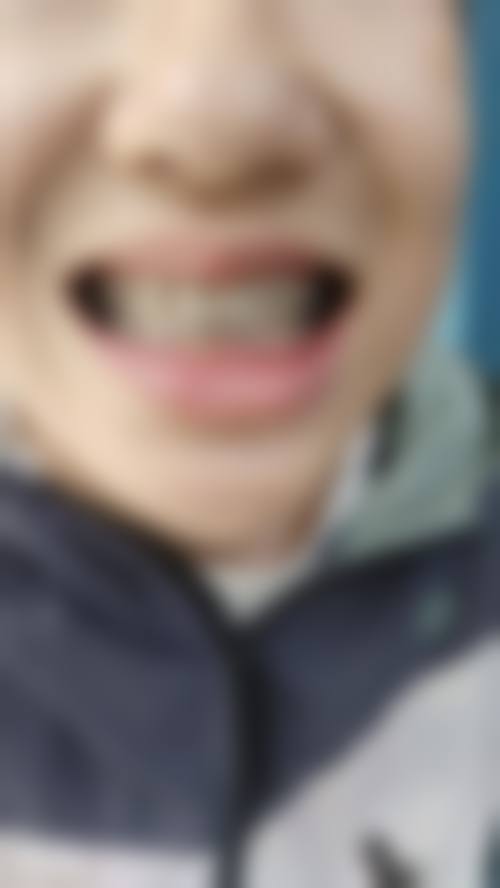 永康胡韵口腔门诊部擅长项目