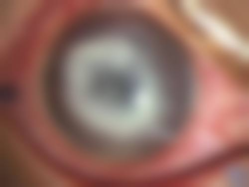 咸宁市中医医院眼科治疗反馈与口碑评价。