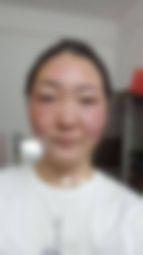 化州韩秀整形医院擅长项目。