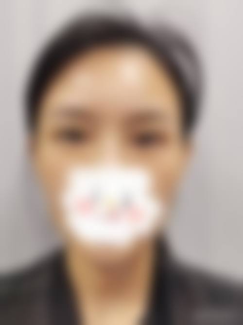 首都医 科 大学附属北京潞河医院眼科医生团队经验稳定。
