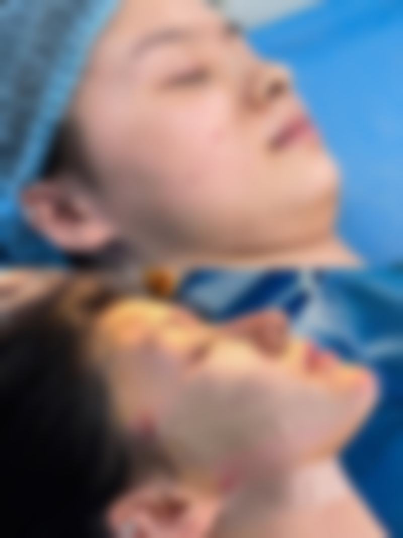 孔江玲医生擅长项目解析