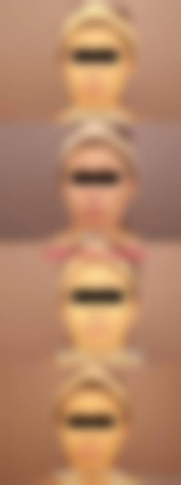 特色项目与技术优势：个性化方案，精细塑美