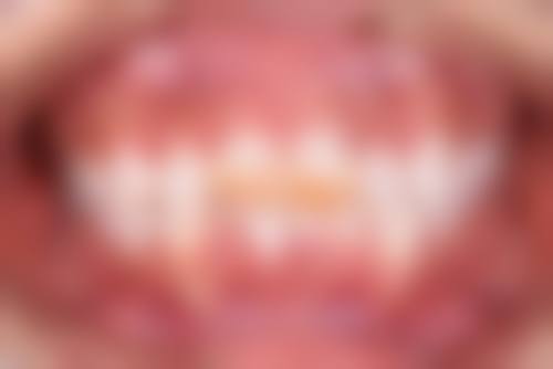 陕西西安牙动力口腔诊所预约挂号方式。