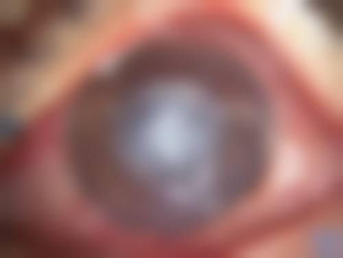 昭通市中医医院眼科地理位置便于到院。