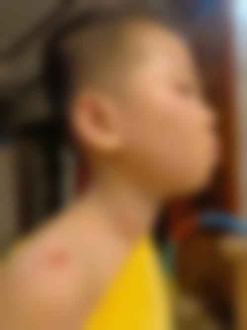 昭通市中医医院眼科擅长项目。
