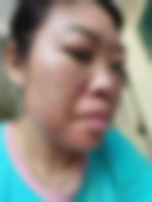 沈阳欣博美医疗美容门诊部2026年价格收费表: