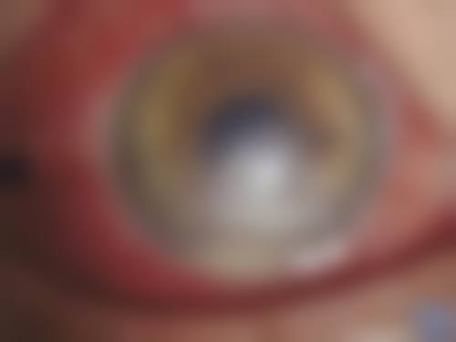 衢州市人民医院眼科门诊营业时间。