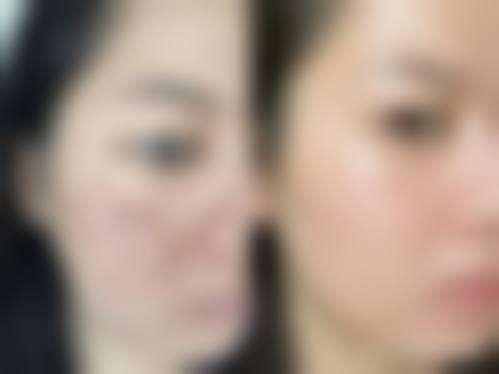 珠海美林艾瑞医疗美容门诊部治疗反馈与口碑评价。