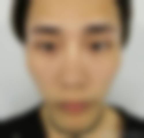 泸州韩美整形美容擅长项目。