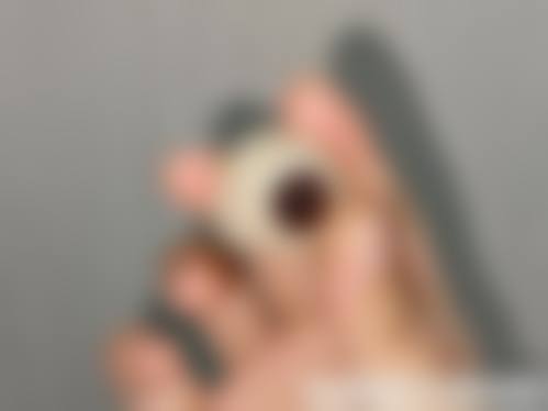 衢州市人民医院眼科医生团队经验稳定。