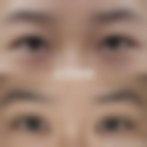 临床实例分享