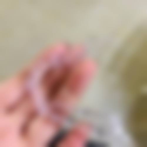 钟元医生技术实力体现