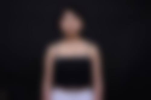沈阳汇美人医疗美容治疗反馈与口碑评价。