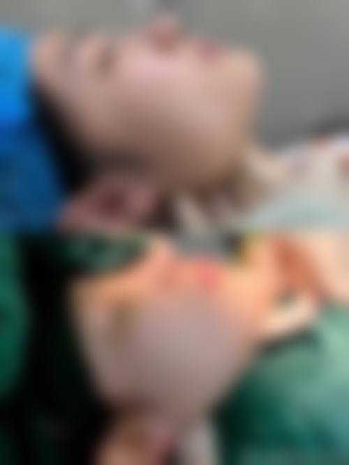 优惠活动详情
