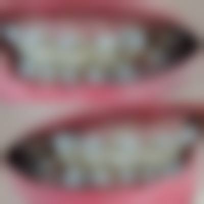 临床实例分享