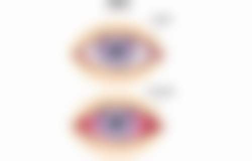 佛山市三水区人民医院眼科门诊营业时间。