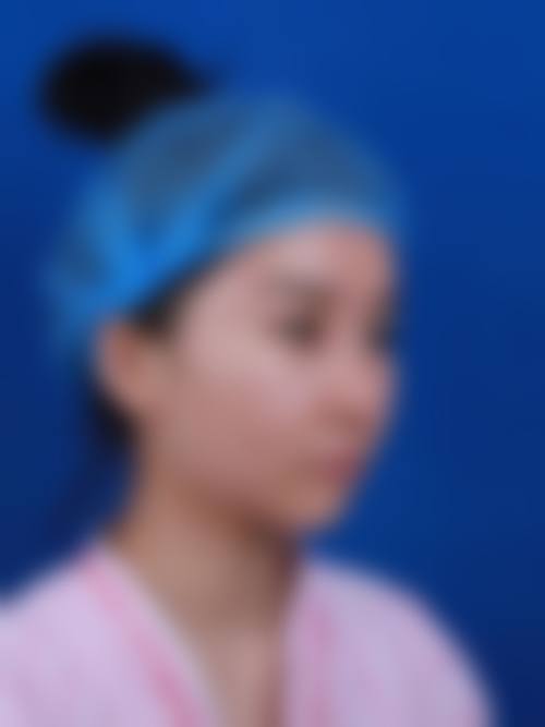 优惠活动详情:限时补贴,降低美丽门槛