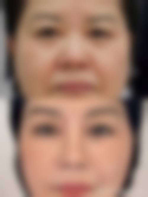 济南臻焕垸整形医院医生团队经验稳定。