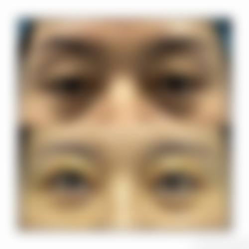 预约优惠活动