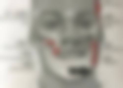 FAQ:宋春鸣医生预约与治疗常见问题