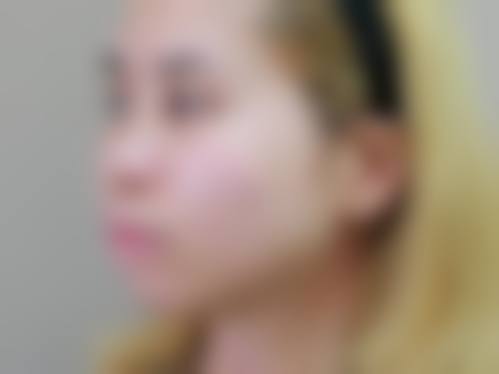 广东深圳汪洋齿科治疗反馈与口碑评价。
