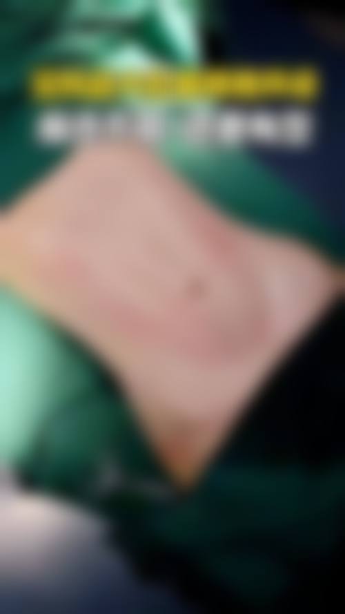 临床实例分享