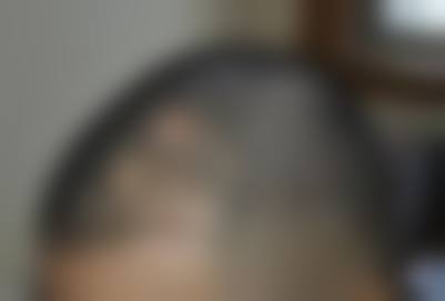 西安美人姬医疗美容门诊部医生团队经验稳定。