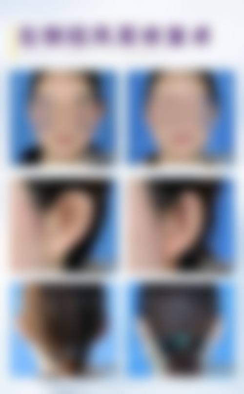 特色科室与项目：覆盖主流医美需求